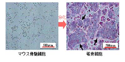 マウス骨髄細胞と破骨細胞